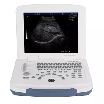 2023 Parka CE Wholesales popoln digitalni ultrazvočni scan medicinske prenosni ultrazvok pralni za Medicinske Bolnišnično Uporabo